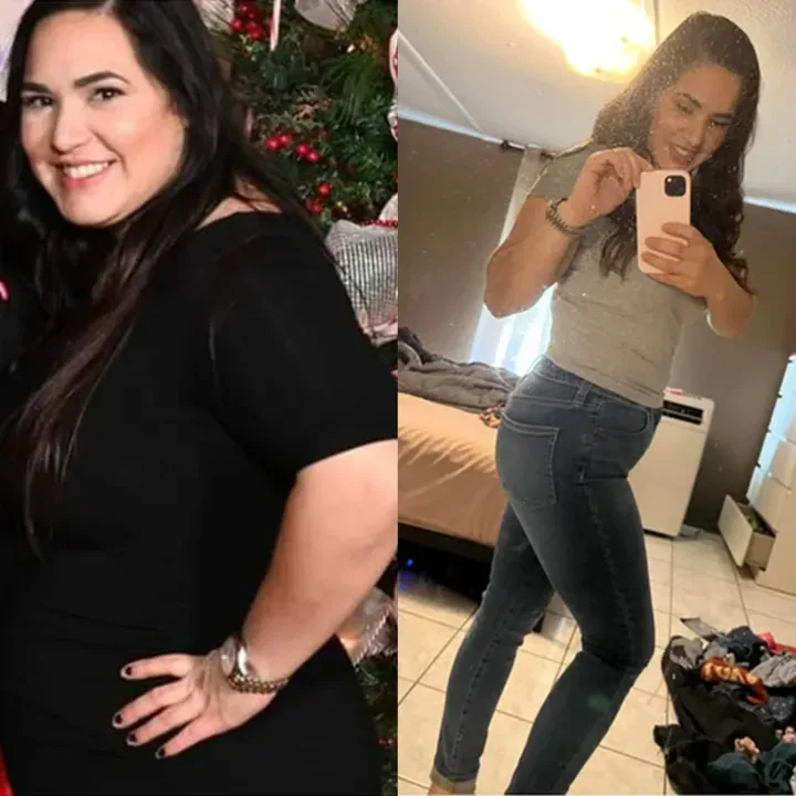Vanessa — before and after, as published by the manufacturer