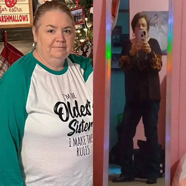Vicki — before and after, as published by the manufacturer